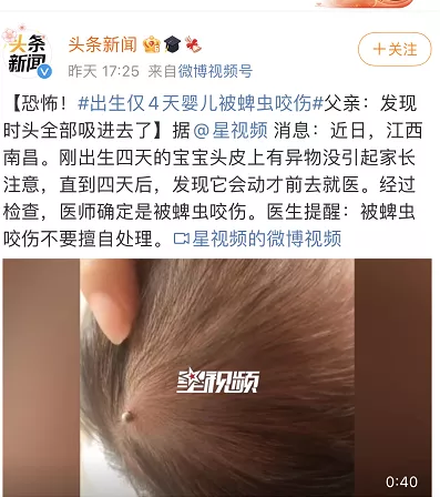 家中的小孩被蜱虫咬了怎么办？如何对付蜱虫？