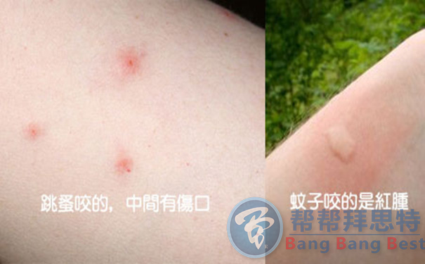 跳蚤的生物习性及危害